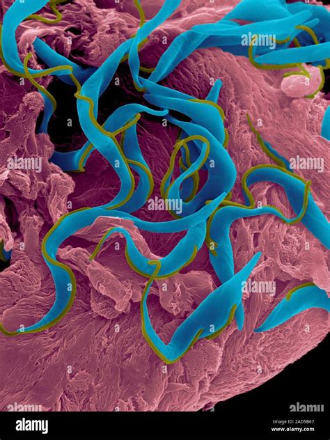 Trypanosome Trypomastigote Trypanosoma Sp Coloured Scanning