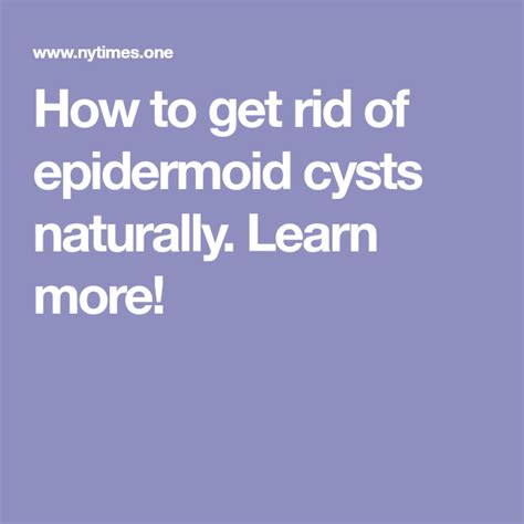 How To Get Rid Of Epidermoid Cysts Naturally Learn More With Images