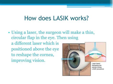 Ppt Comprehensive Guide To Bladeless Lasik Eye Surgery Powerpoint