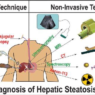 Illustration Of Invasive And Non Invasive Technique Available For The