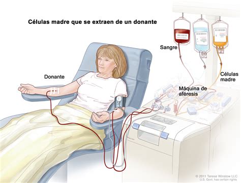 Allogeneic Stem Cell Transplant Patient Siteman Cancer Center