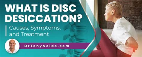 What Is Disc Desiccation? Causes, Symptoms, and Treatment