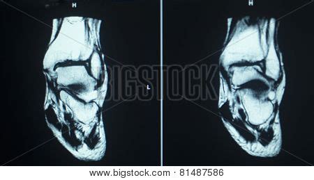 Mri Scan Test Results Image & Photo (Free Trial) | Bigstock