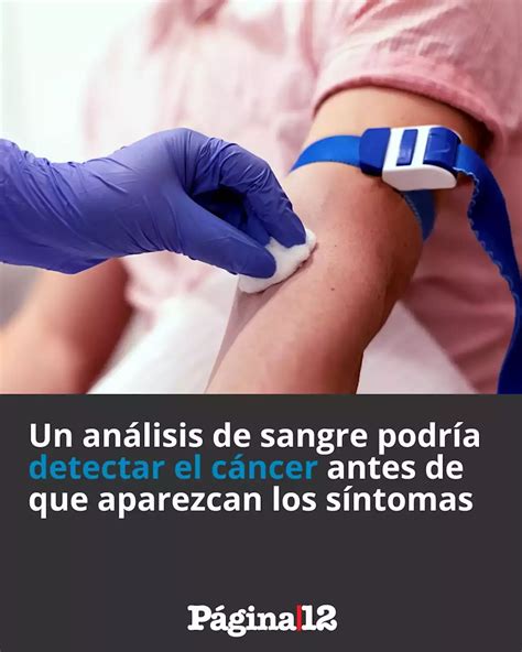 Lucha Contra El C Ncer Un An Lisis De Sangre Podr A Detectar La