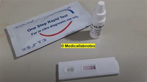 Helicobacter Pylori Antibody Test Introduction Principle Test Requi