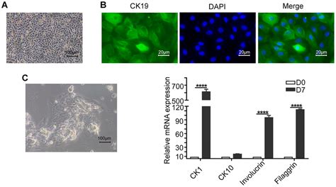 LOXL2 From Human Amniotic Mesenchymal Stem Cells Accelerates Wound