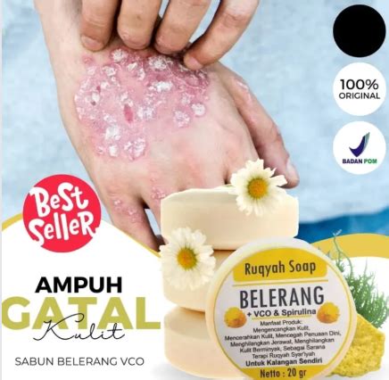 Sabun Gatal Kulit Paling Ampuh Sabun Belerang Untuk Gatal Sabun Muka