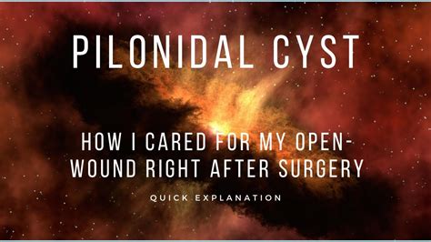 Pilonidal Cyst Open Wound Care My First Gauze Change YouTube