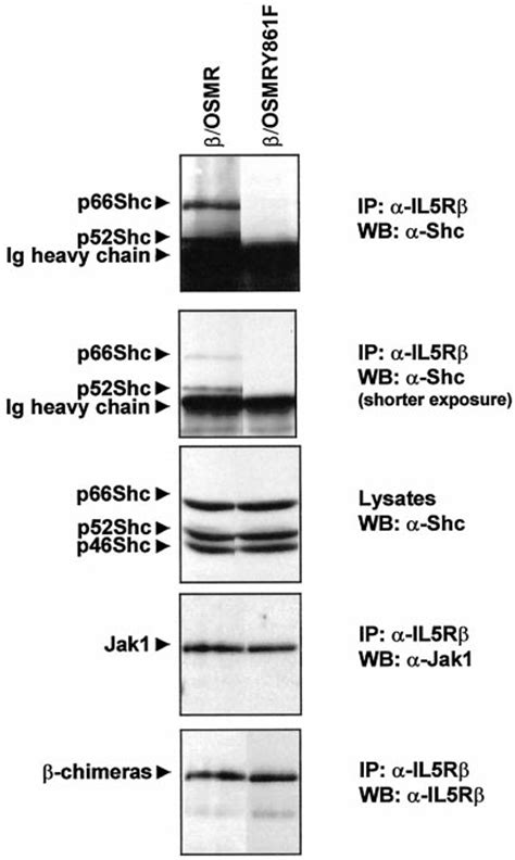 Shc Associates With The Cytoplasmic Part Of The Osmr Cos 7 Cells Were