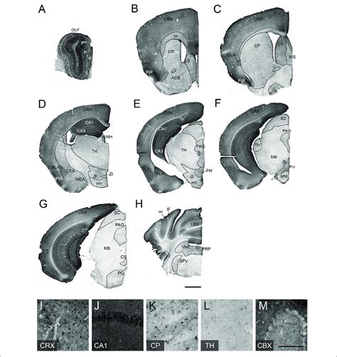 Tcf Expression Patterns Of Adult Mouse Brain A H Dab