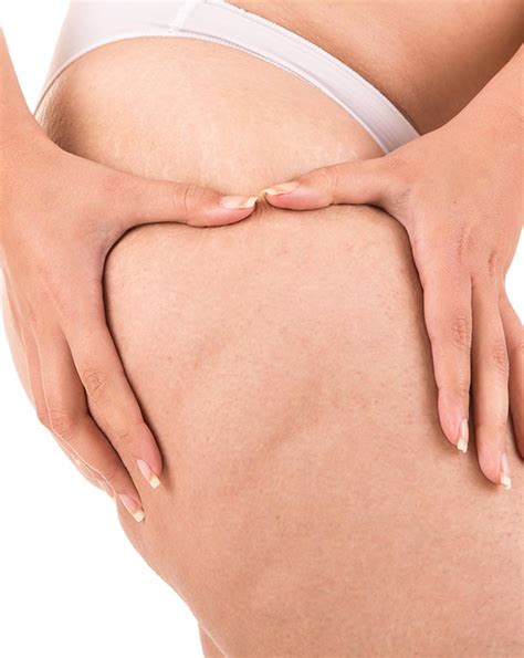 Cellulite Xd Aesthetics Clinic Singapore