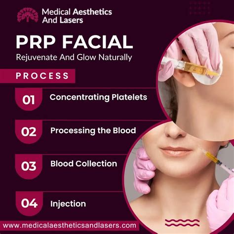 Prp Facial Rejuvenate And Glow Medical Aesthetics And Lasers