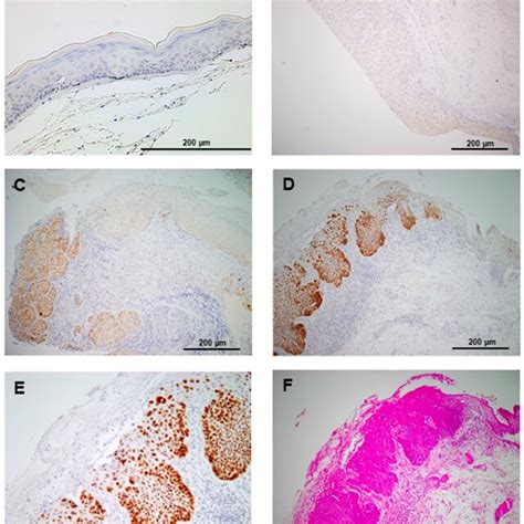 Immunohistochemical Analysis Of Sox2 Sex Determining Region Y Box 2