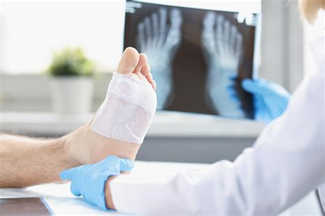 Total Ankle Replacement Understanding The Procedure