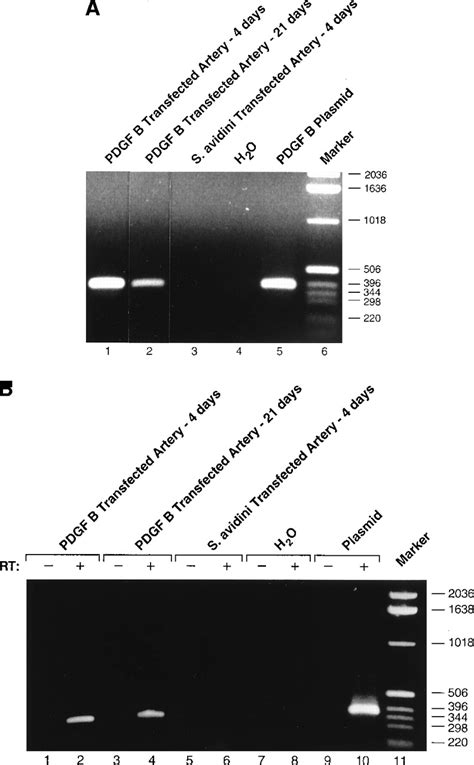 Expression And Function Of A Recombinant PDGF B Gene In Porcine