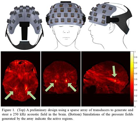 Multi Focal Ultrasound Neuromodulation A Feasibility Study Brain