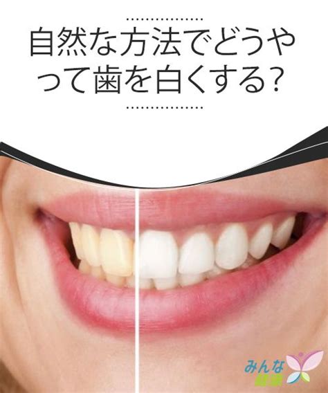 自然な方法でどうやって歯を白くする？ 歯を白く 歯のホワイトニング 歯 白く