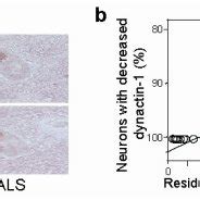 Dysregulation Of Dynactin 1 In Amyotrophic Lateral Sclerosis ALS A