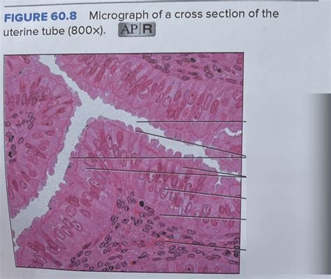 View Uterus Histology Diagram Labeled