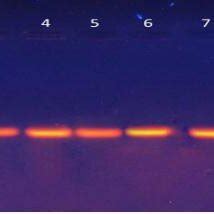 Ethidium Bromide Stained Agarose Gel Electrophoresis Of PCR Products