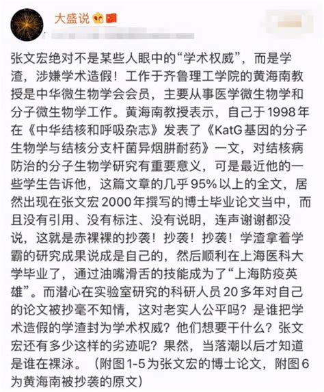 張文宏身陷論文抄襲風波，復旦正式回應，這3個事實誰也無法否認 每日頭條