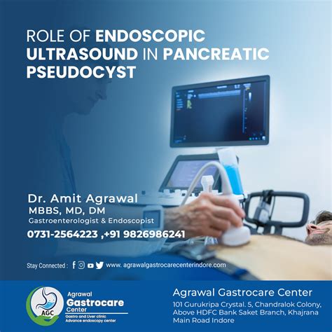 Role Of Endoscopic Ultrasound In Pancreatic Pseudocyst Agrawal