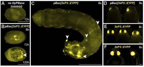 Somatic And Germline Transgenesis Of Xp Eyfp In Plodia A Weak