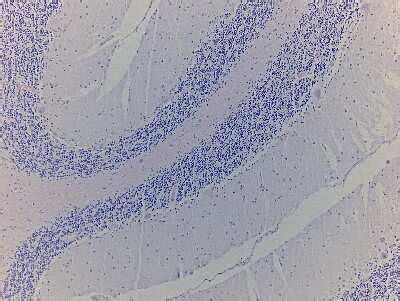 Brain Cerebellum Tissue Slides Alzheimer S Paraffin NBP2 77823