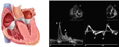 Diastology A Practical Approach To Diagnosis Of Heart Failure With Preserved Ejection Fraction