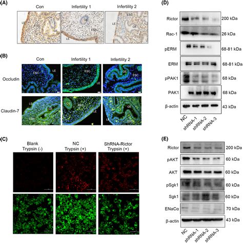 Rictor MTORC2 Is Involved In Endometrial Receptivity By Regulating