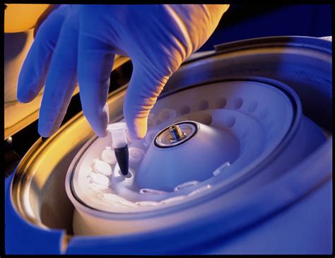 What Is Centrifugation Definition Process Uses Video Lesson | My XXX ...