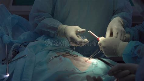 Operation Using Laparoscopic Equipment Surgeons Team Working With Of