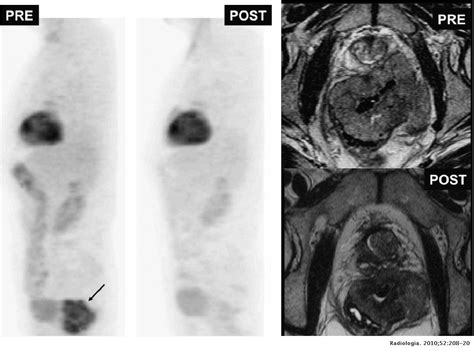 Imagen Funcional Tumoral Parte 2 Radiología