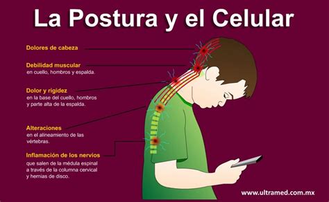 La Mala Postura Por Mirar El M Vil El Nuevo S Ndrome Del Siglo Xxi