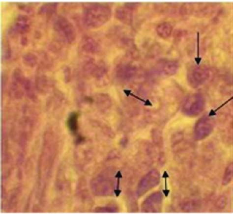 Histopathological Appearance Of Mammary Gland Tumor Download