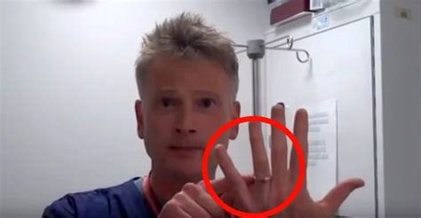 Do You Have A Ring Stuck On Your Finger? With This Trick Of The Doctor, No Need To Worry ...