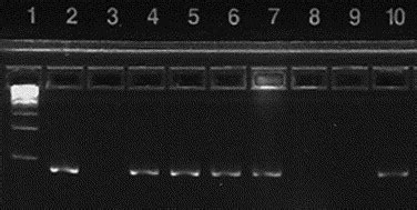 Rose Bengal And Lissamine Green Inhibit Detection Of Herpes Simplex