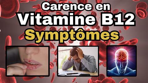 Sympt Mes Les Plus Fr Quents D Une Carence En Vitamine B Youtube