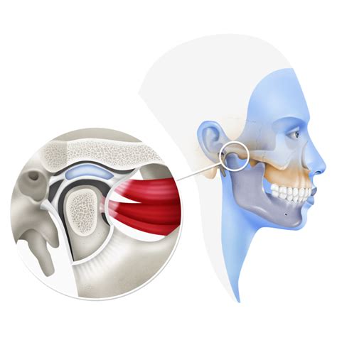 Trastornos de la Articulación Temporomandibular Clinica maxilofacial