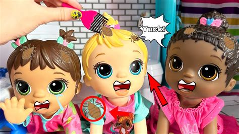 Baby Alive Triplets Have Lice 😰 Youtube