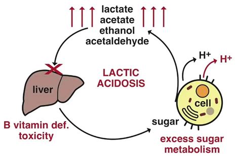 Acidoza Lactica Clasificare Etiopatogenica Si Diagnostic Dr Petrache