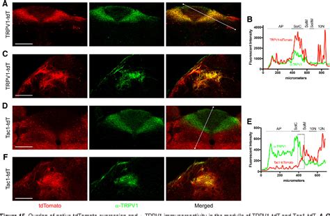 Figure 1 From Mapping Of Sensory Nerve Subsets Within The Vagal Ganglia