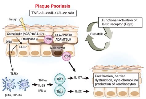 Highlighting Interleukin 36 Signalling In Plaque Psoriasis And Pustular