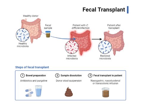 Fecal Transplant BioRender Science Templates