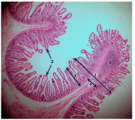 Bctc Bio Ileum Slide Digestive System Diagram Quizlet