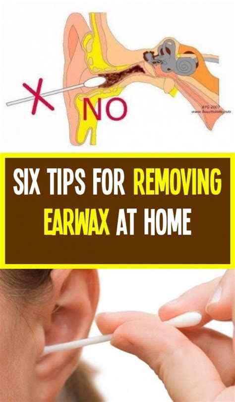 Ear Wax Removal Thing