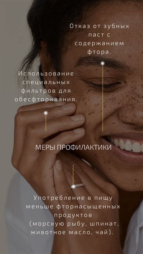 Флюороз 4 | Флюороз, Стоматологические факты, Стоматология
