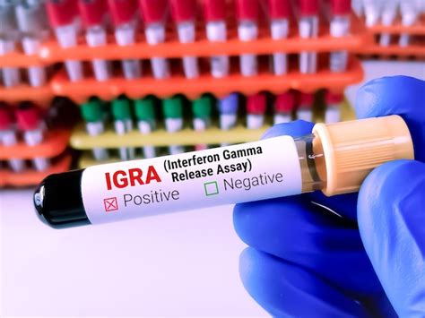 Premium Photo Blood Sample For Igra Interferon Gamma Release Assay Test