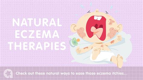 7 natural eczema remedies to try