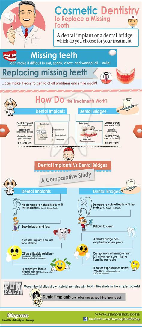 Dental Bridges Pros and Cons - HRF